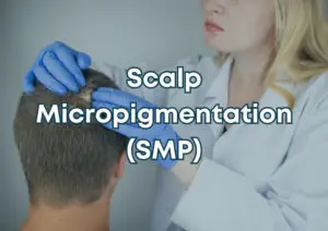 Professional practitioner performing Scalp Micropigmentation treatment on client
